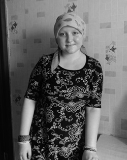 アーニャ　ベラルーシ・ゴメリ市。 13歳。悪性リンパ腫。化学療法を受けている。